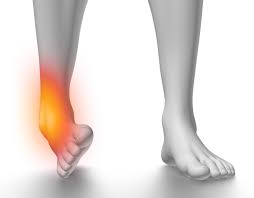 Ankle rehabilitation advice